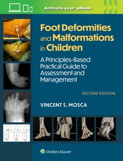 Front cover_Foot Deformities and Malformations in Children