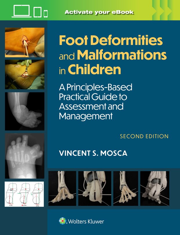 Front cover_Foot Deformities and Malformations in Children