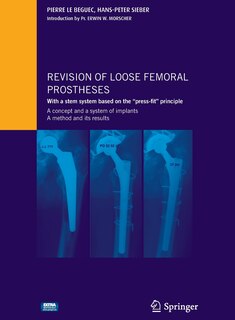 Couverture_Revision of loose femoral prostheses with a stem system based on the press-fit principle