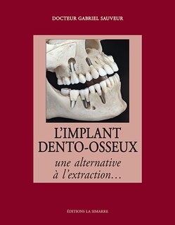 Couverture_L'implant dento-osseux : une alternative à l'extraction...