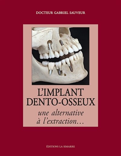 Couverture_L'implant dento-osseux : une alternative à l'extraction...