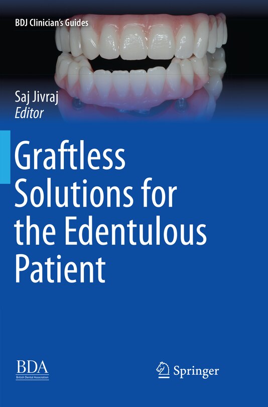 Front cover_Graftless Solutions For The Edentulous Patient