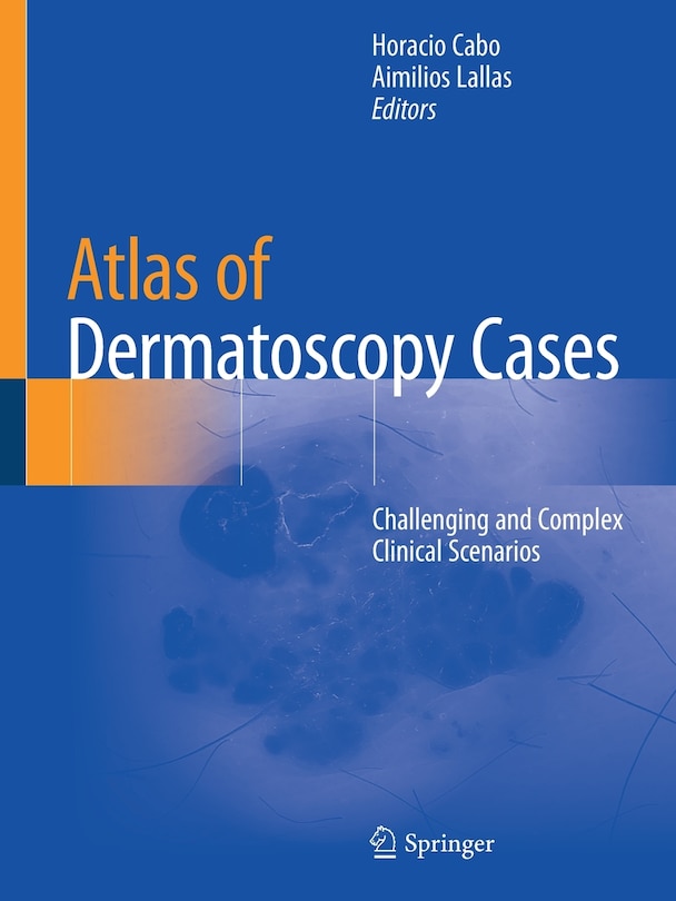 Front cover_Atlas Of Dermatoscopy Cases