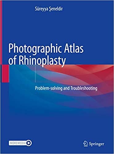 Front cover_Photographic Atlas Of Rhinoplasty