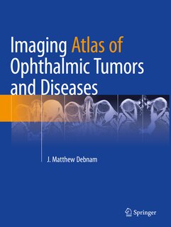 Front cover_Imaging Atlas of Ophthalmic Tumors and Diseases