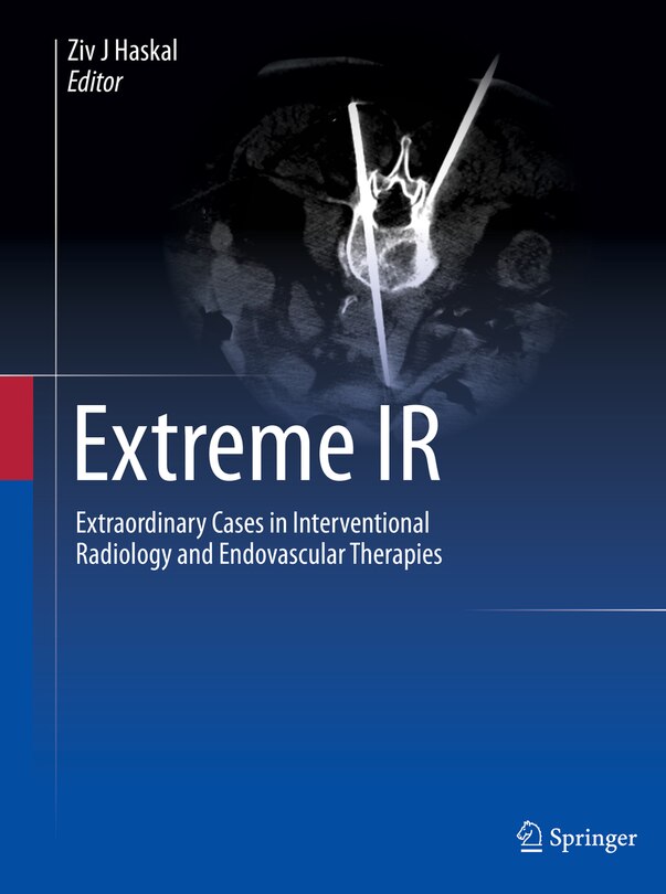 Couverture_Extreme IR