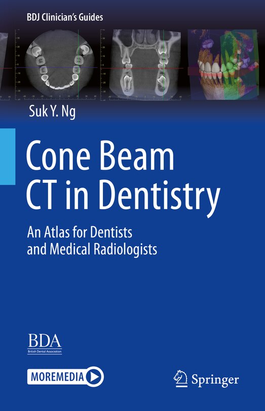 Couverture_Cone Beam CT in Dentistry