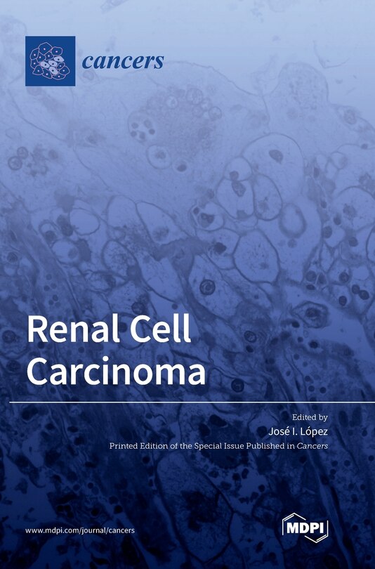 Renal Cell Carcinoma