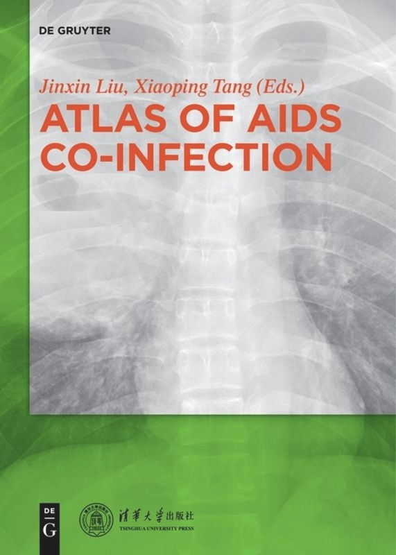 Couverture_Atlas of AIDS Co-infection