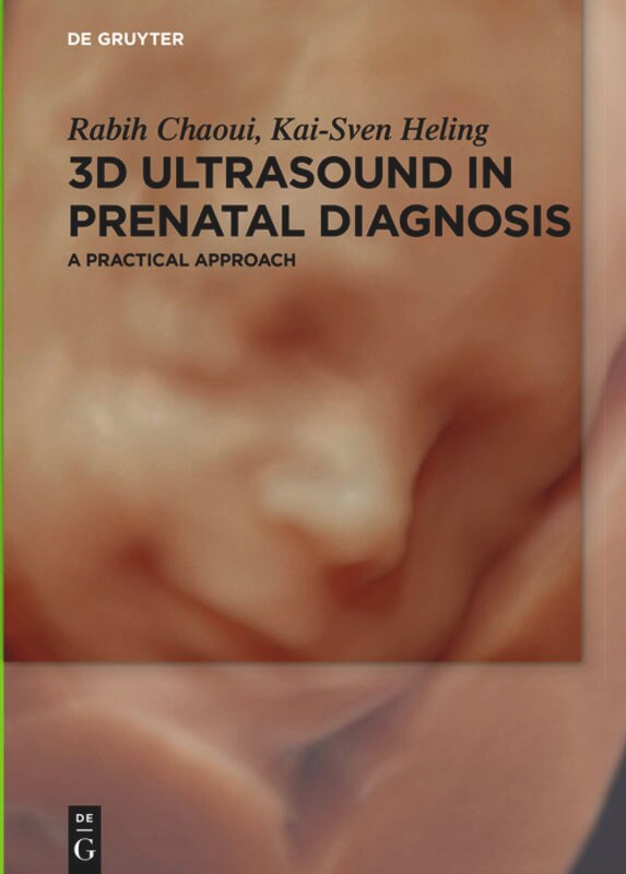 Front cover_3D Ultrasound in Prenatal Diagnosis