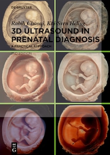 Front cover_3D Ultrasound in Prenatal Diagnosis