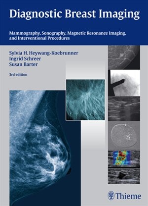 Front cover_Diagnostic Breast Imaging