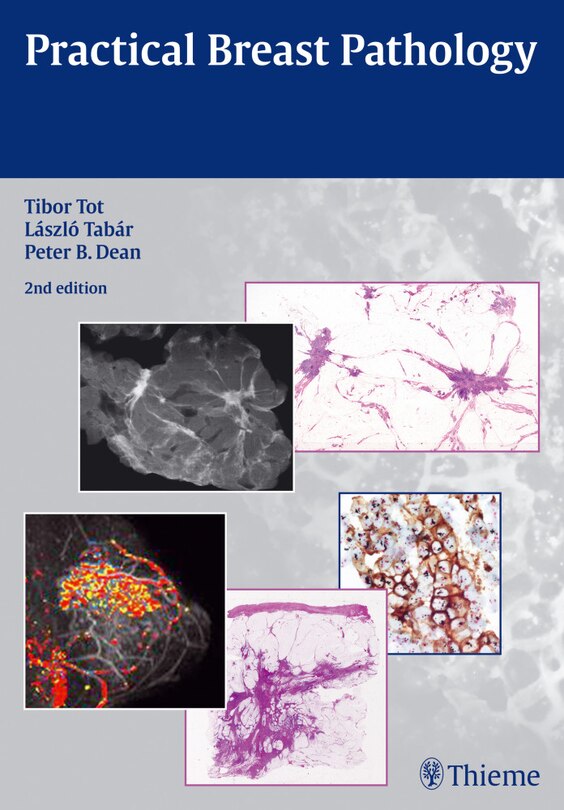 Front cover_Practical Breast Pathology