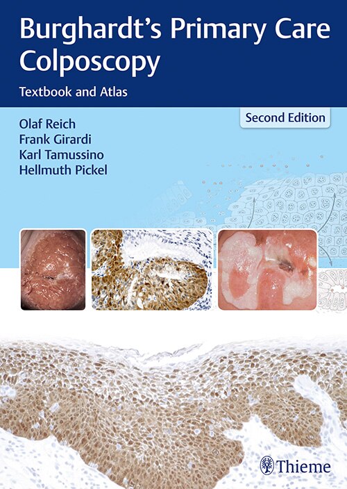 Front cover_Burghardt's Primary Care Colposcopy