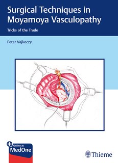 Front cover_Surgical Techniques In Moyamoya Vasculopathy