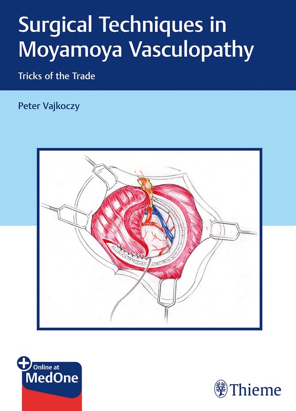 Front cover_Surgical Techniques In Moyamoya Vasculopathy
