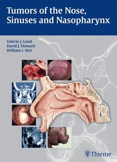 Couverture_Tumors Of The Nose, Sinuses And Nasopharynx