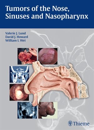 Couverture_Tumors Of The Nose, Sinuses And Nasopharynx