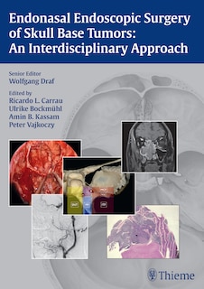 Couverture_Endonasal Endoscopic Surgery Of Skull Base Tumors
