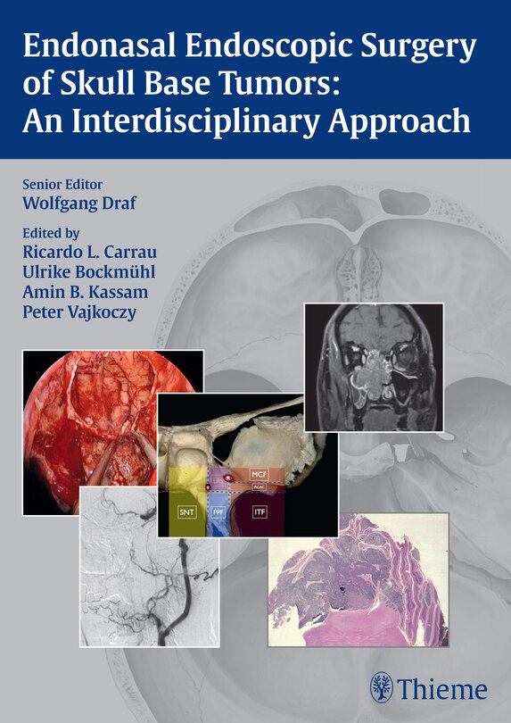 Couverture_Endonasal Endoscopic Surgery Of Skull Base Tumors