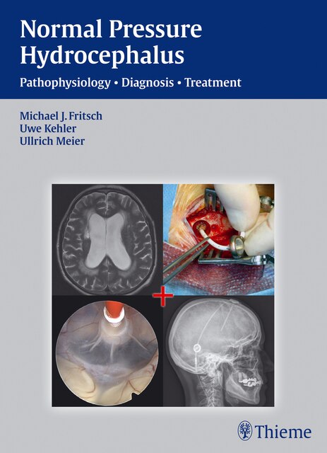 Front cover_Nph - Normal Pressure Hydrocephalus