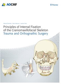 Front cover_Principles Of Internal Fixation Of The Craniomaxillofacial Skeleton