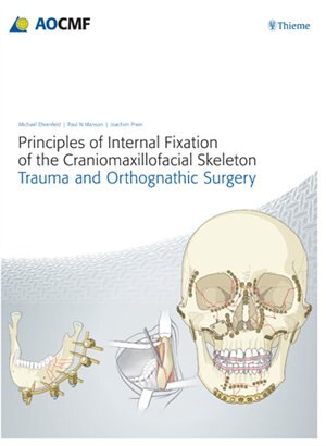 Front cover_Principles Of Internal Fixation Of The Craniomaxillofacial Skeleton
