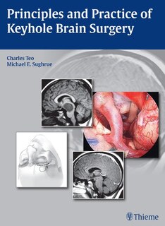 Couverture_Principles And Practice Of Keyhole Brain Surgery