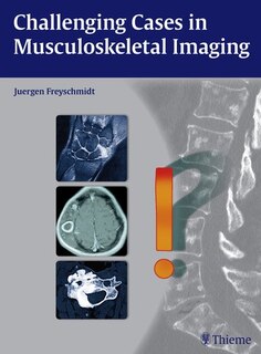 Couverture_Challenging Cases In Musculoskeletal Imaging