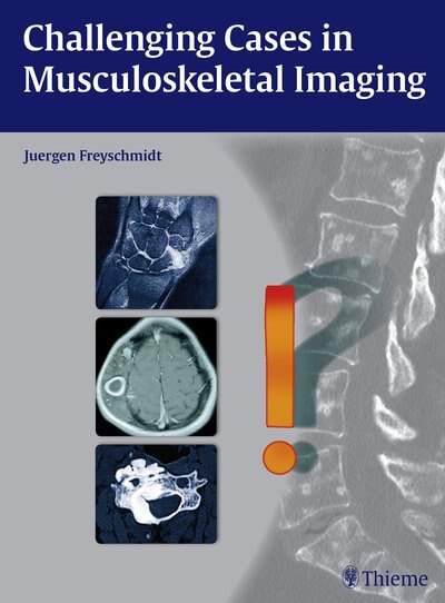Couverture_Challenging Cases In Musculoskeletal Imaging