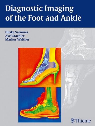 Couverture_Diagnostic Imaging Of The Foot And Ankle