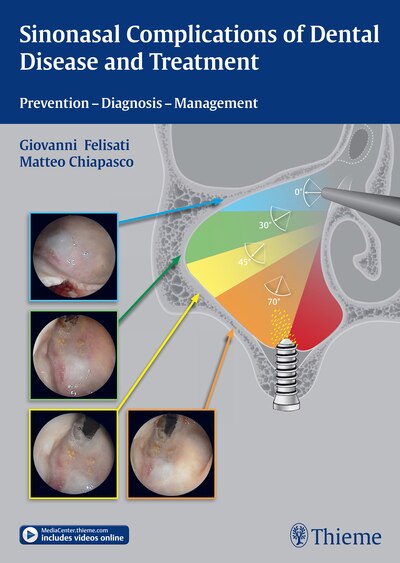 Front cover_Sinonasal Complications Of Dental Disease And Treatment