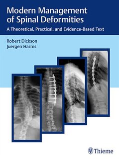Front cover_Modern Management Of Spinal Deformities