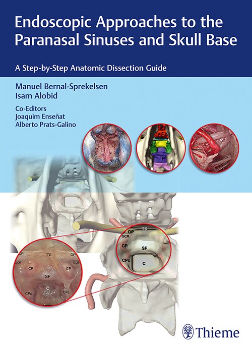 Couverture_Endoscopic Approaches To The Paranasal Sinuses And Skull Base