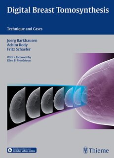 Couverture_Digital Breast Tomosynthesis