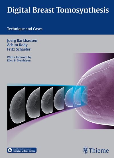 Couverture_Digital Breast Tomosynthesis