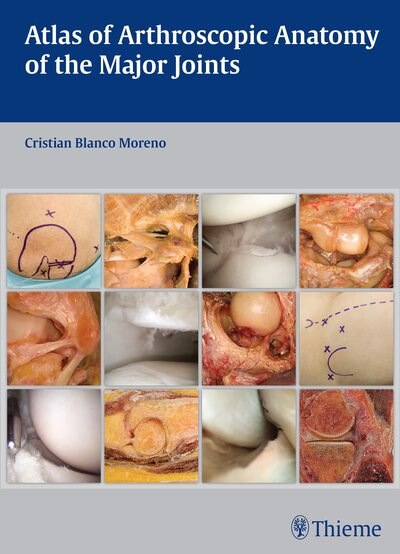 Couverture_Atlas Of Arthroscopic Anatomy Of The Major Joints