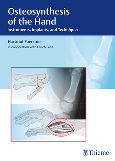 Front cover_Osteosynthesis Of The Hand
