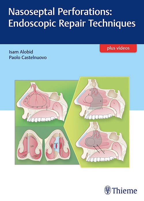 Couverture_Nasoseptal Perforations