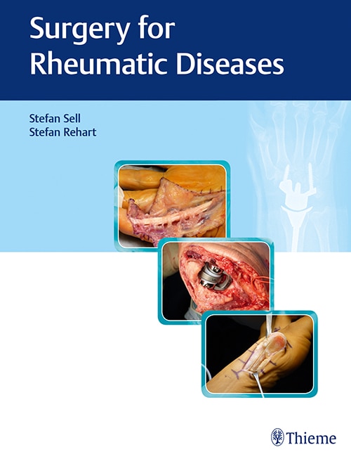 Couverture_Surgery For Rheumatic Diseases