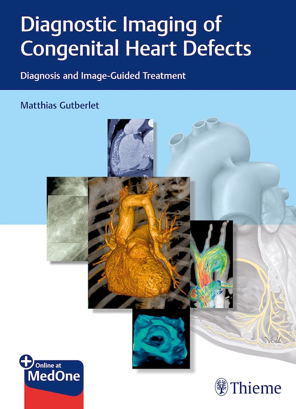 Front cover_Diagnostic Imaging Of Congenital Heart Defects