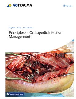 Front cover_Principles Of Orthopedic Infection Management