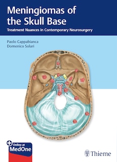 Couverture_Meningiomas Of The Skull Base