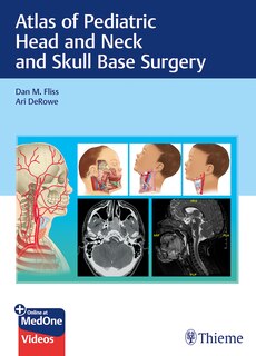 Front cover_Atlas Of Pediatric Head And Neck And Skull Base Surgery