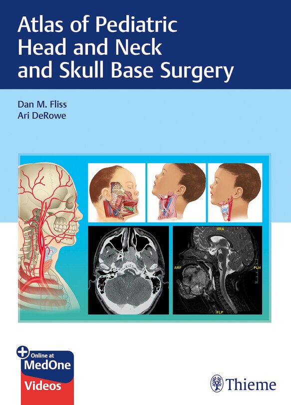 Front cover_Atlas Of Pediatric Head And Neck And Skull Base Surgery