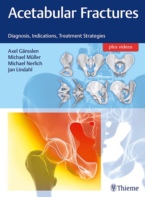 Front cover_Acetabular Fractures