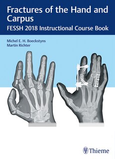 Couverture_Fractures Of The Hand And Carpus