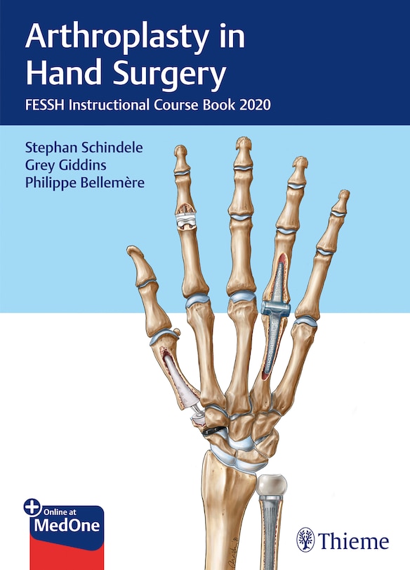 Front cover_Arthroplasty In Hand Surgery