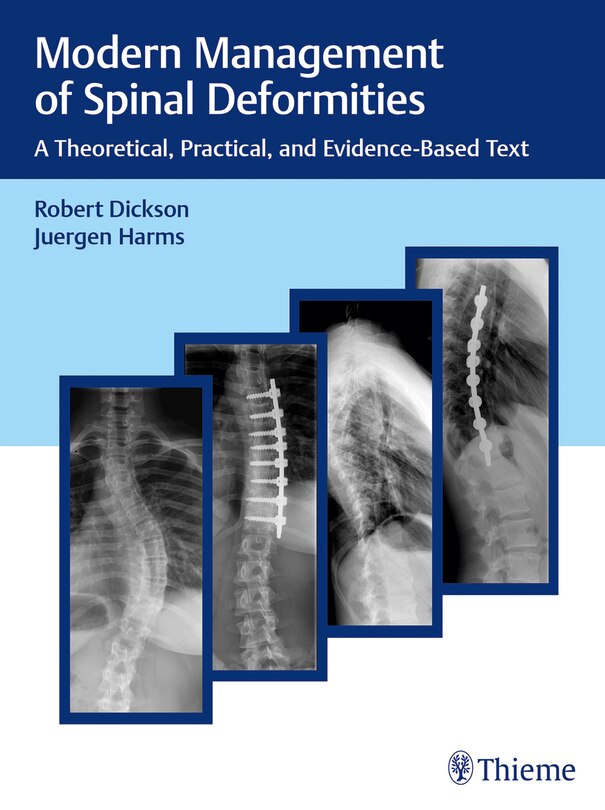 Couverture_Modern Management Of Spinal Deformities