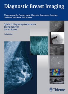 Couverture_Diagnostic Breast Imaging